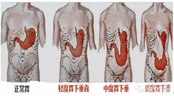 胃在身体上哪个部位？很多人都搞不清楚