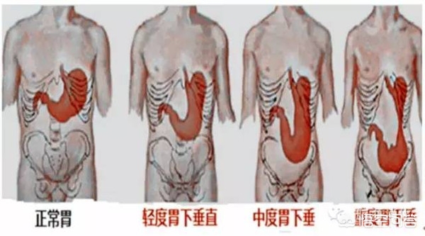 胃在身体上哪个部位？很多人都搞不清楚